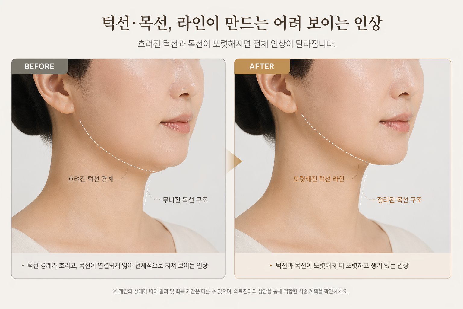 얼굴선 개선 예시 이미지