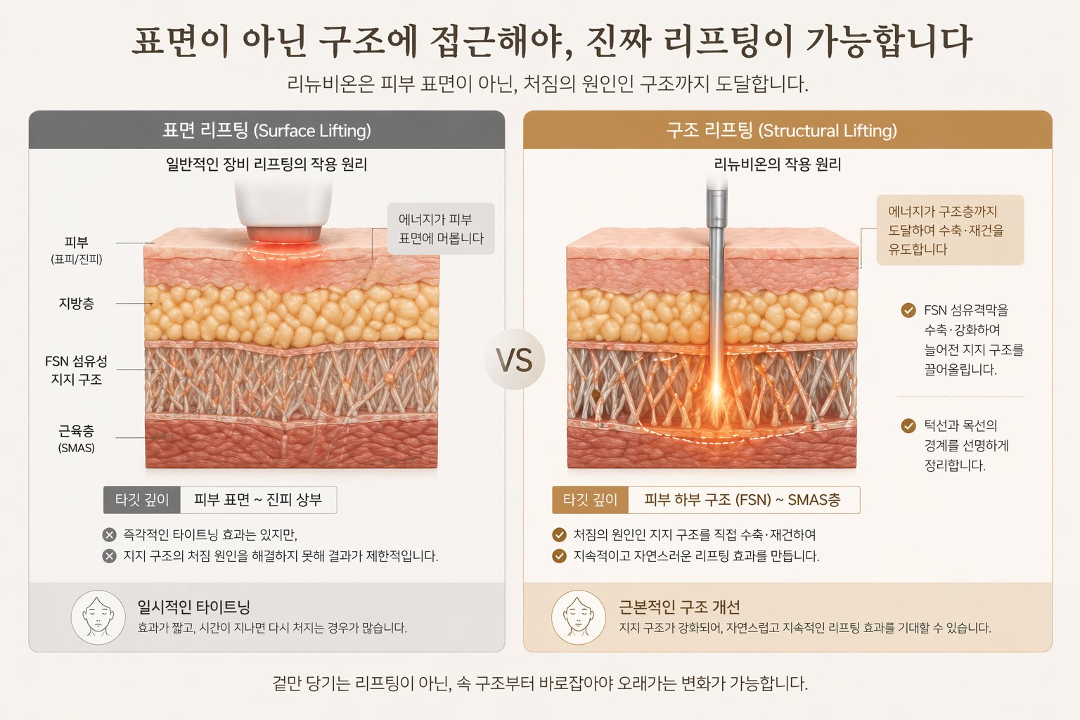 리뉴비온 추가 설명 이미지
